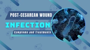 Post-cesarean wound infection: symptoms and treatments