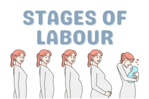 Stages of labour