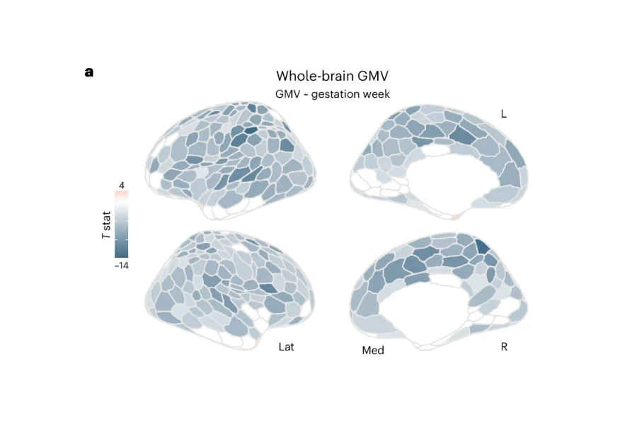 The research found change in gray matter volume with each week of pregnancy - the darker colours show, the more brain regions is most affected