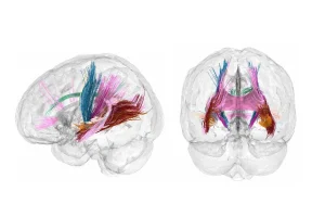 Tracts of white matter rise during pregnancy