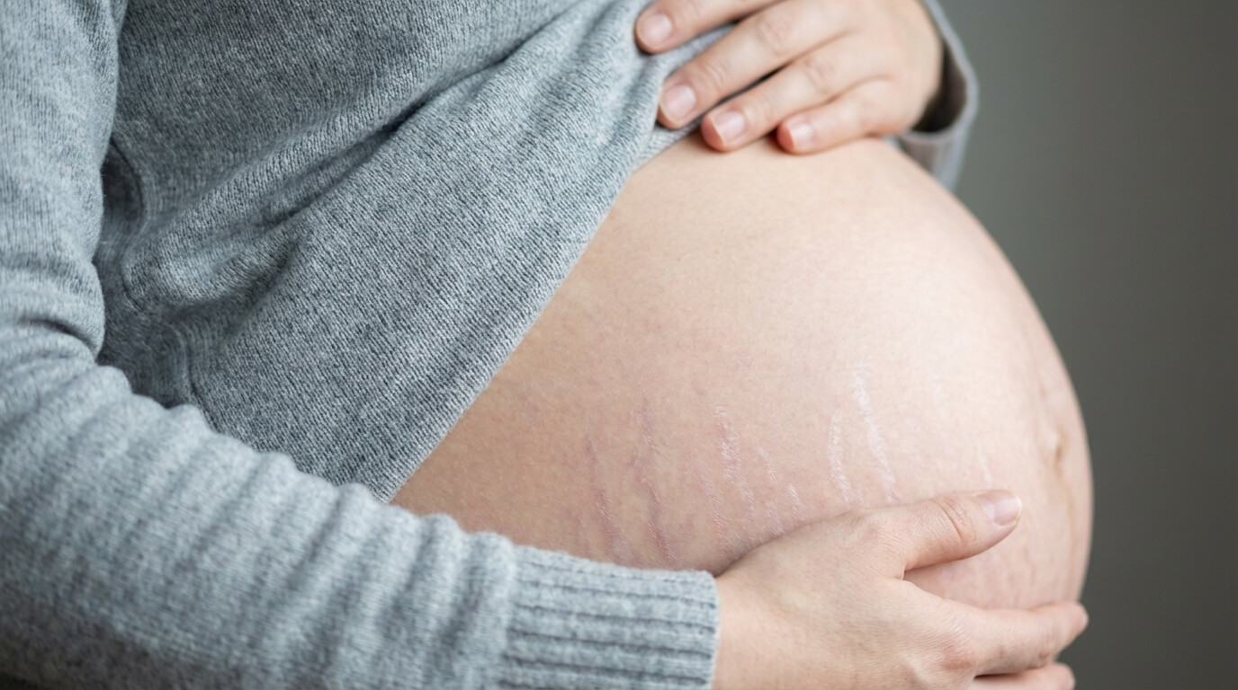 close up of a pregnant belly with faint stretch marks forming near the lower abdomen